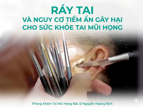 Thói Quen Lấy Ráy Tai Mỗi Ngày: Nguy Cơ Tiềm Ẩn Gây Nhiều Bệnh Về Tai