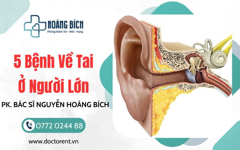 Phòng khám tai mũi họng BS Nguyễn Hoàng Bích chuyên khám các bệnh về tai
