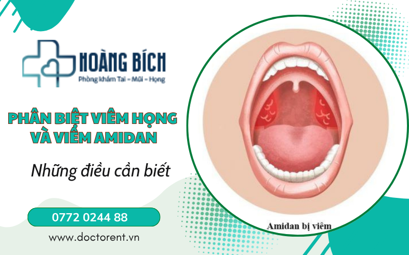 Phân biệt viêm họng và viêm Amidan BS Nguyễn Hoàng Bích