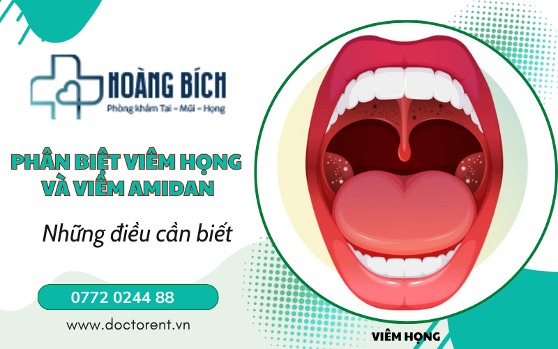 Phân biệt viêm họng và viêm Amidan BS Nguyễn Hoàng Bích