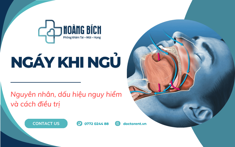 Ngáy khi ngủ